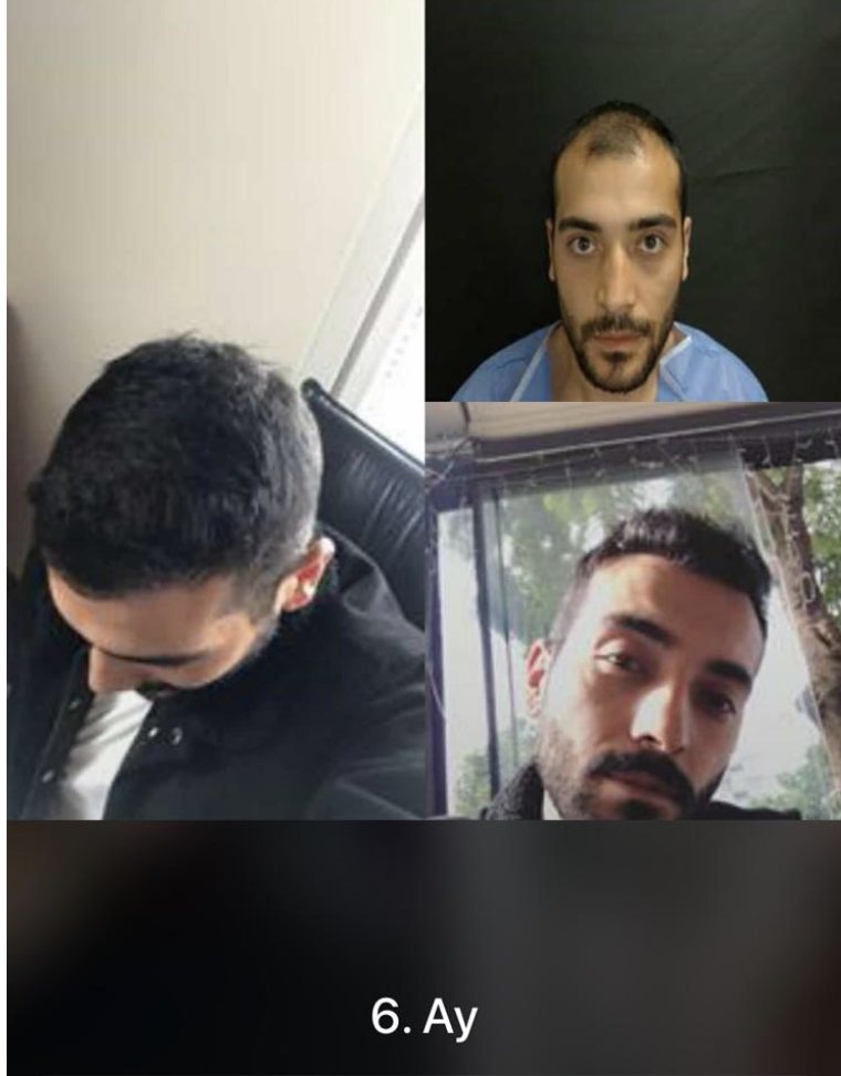 6. ay sonucu