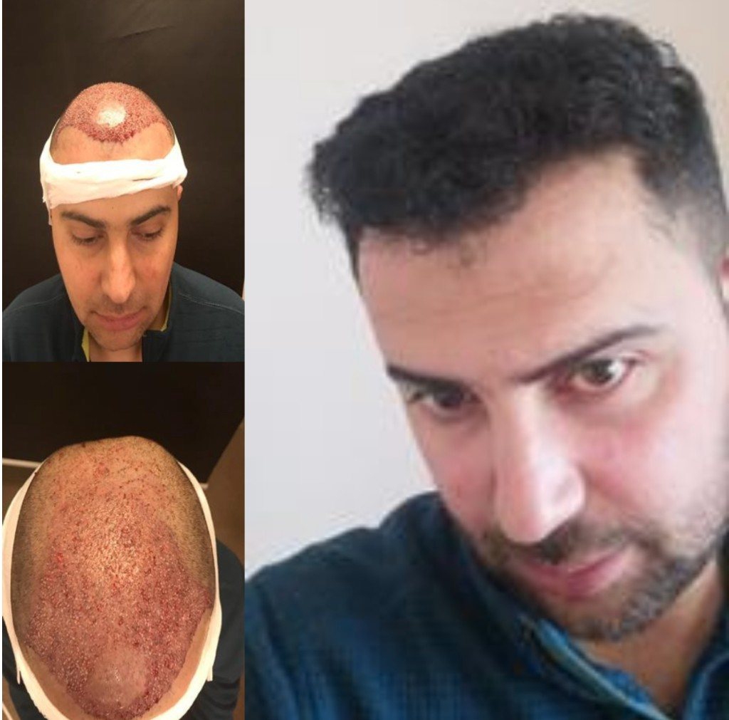 Operasyon ve sonuç